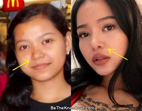 Bella Poarch in 2024: Transformation Before Surgery Revealed